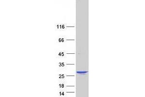 Validation with Western Blot (Transgelin 3 Protein (TAGLN3) (Transcript Variant 3) (Myc-DYKDDDDK Tag))