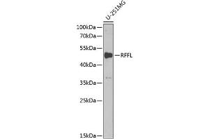 Western blot analysis of extracts of U-251MG cells, using RFFL antibody (ABIN6130665, ABIN6146886, ABIN6146888 and ABIN6222152) at 1:1000 dilution. (RFFL antibody  (AA 1-190))