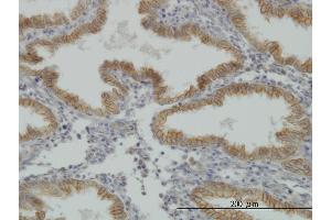 Immunoperoxidase of monoclonal antibody to MUSK on formalin-fixed paraffin-embedded human endometrium. (MUSK antibody  (AA 301-400))