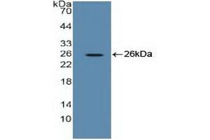 Detection of Recombinant EEF2, Human using Polyclonal Antibody to Eukaryotic Translation Elongation Factor 2 (EEF2) (EEF2 antibody  (AA 32-233))