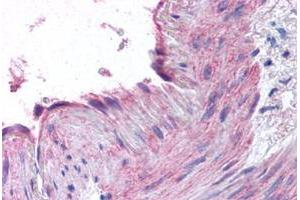 Immunohistochemical staining of human small intestine, vessel with CCR1 polyclonal antibody . (CCR1 antibody  (N-Term))