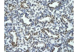 Rabbit Anti-TRIOBP Antibody       Paraffin Embedded Tissue:  Human alveolar cell   Cellular Data:  Epithelial cells of renal tubule  Antibody Concentration:   4. (TRIOBP antibody  (Middle Region))
