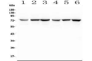anti-Solute Carrier Family 5 (Sodium/glucose Cotransporter), Member 2 (SLC5A2) (AA 15-656) antibody