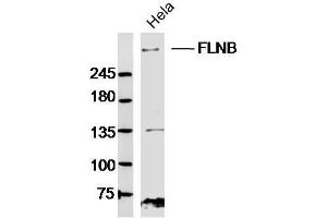 Hela lysates probed with FLNB Polyclonal Antibody, Unconjugated  at 1:300 dilution and 4˚C overnight incubation. (FLNB antibody  (AA 1551-1650))