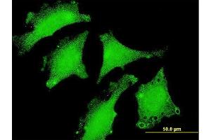 Immunofluorescence of monoclonal antibody to DND1 on HeLa cell.