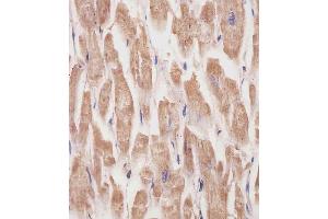 (ABIN6242162 and ABIN6577231) staining KANK1 in human heart tissue sections by Immunohistochemistry (IHC-P - paraformaldehyde-fixed, paraffin-embedded sections). (ANKRD15 antibody)
