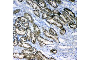 IHC analysis of Glycerol kinase using anti-Glycerol kinase antibody . (Glycerol Kinase antibody  (AA 1-180))