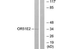 Western blot analysis of extracts from Jurkat cells, using OR51E2 Antibody.