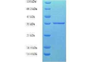 ZMAT5 Protein (AA 1-170, full length) (His-SUMO Tag)