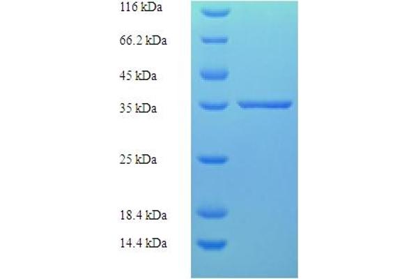 ZMAT5 Protein (AA 1-170, full length) (His-SUMO Tag)