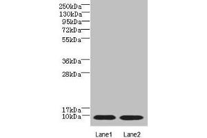Western blot All lanes: NOP10 antibody at 4 μg/mL Lane 1: Jurkat whole cell lysate Lane 2: Caco-2 whole cell lysate Secondary Goat polyclonal to rabbit IgG at 1/10000 dilution Predicted band size: 8 kDa Observed band size: 8 kDa (rRNA 2'-O-Methyltransferase Fibrillarin (FBL) (AA 1-64) antibody)