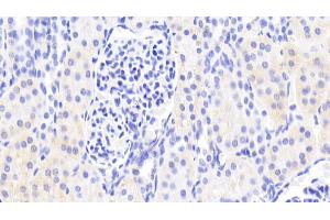 Detection of DHODH in Human Kidney Tissue using Polyclonal Antibody to Dihydroorotate Dehydrogenase (DHODH) (DHODH antibody  (AA 35-392))