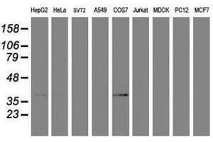 Image no. 4 for anti-Prenyl (Decaprenyl) Diphosphate Synthase, Subunit 2 (PDSS2) antibody (ABIN1500138) (PDSS2 antibody)