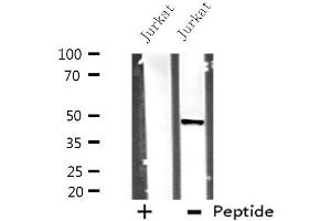 DHODH antibody  (Internal Region)