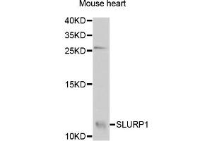 Western blot analysis of extracts of Mouse heart cells, using SLURP1 antibody. (SLURP1 antibody)