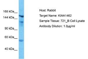 Host: Rabbit Target Name: KIAA1462 Sample Type: 721_B Whole Cell lysates Antibody Dilution: 1. (JCAD/KIAA1462 antibody  (N-Term))