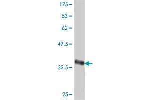 Western Blot detection against Immunogen (36. (RING1 antibody  (AA 81-170))