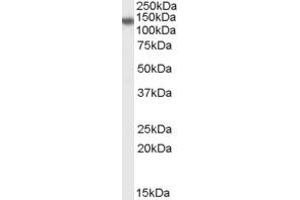 Western Blotting (WB) image for anti-Disabled Homolog 2, Mitogen-Responsive phosphoprotein (Drosophila) (DAB2) (N-Term) antibody (ABIN2156670) (DAB2 antibody  (N-Term))