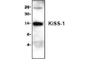 Image no. 1 for anti-KiSS-1 Metastasis-Suppressor (KISS1) (N-Term) antibody (ABIN127218) (KISS1 antibody  (N-Term))