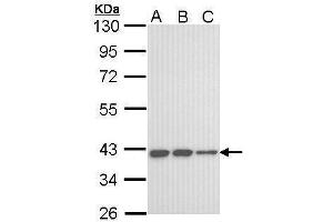 WB Image Sample (30 ug of whole cell lysate) A: A431 , B: H1299 C: Hela 10% SDS PAGE antibody diluted at 1:1000 (KIR3DL2 antibody  (C-Term))