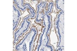 Immunohistochemical staining (Formalin-fixed paraffin-embedded sections) of human duodenum with DLC1 polyclonal antibody  shows distinct positivity of microvilli in glandular cells.