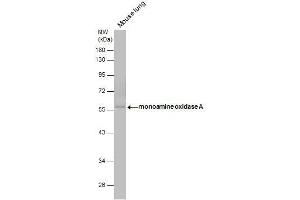 WB Image monoamine oxidase A antibody [N2C3] detects monoamine oxidase A protein by western blot analysis. (Monoamine Oxidase A antibody  (Center))