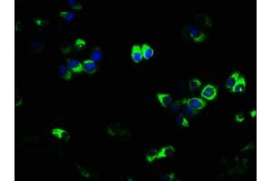 Immunofluorescence staining of PC-3 cells with ABIN7173843 at 1:133, counter-stained with DAPI. (TNFRSF11A antibody  (AA 28-202))