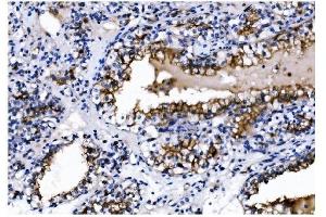 IHC analysis of CD13/ANPEP using anti-CD13/ANPEP antibody (ABIN7600088).