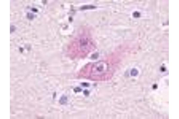 GPR37L1 antibody  (Cytoplasmic Domain)