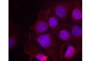 Immunofluorescence staining of methanol-fixed MCF-7 cells using Phospho-ESR1-S118 antibody (ABIN2987431). (Estrogen Receptor alpha antibody  (pSer118))