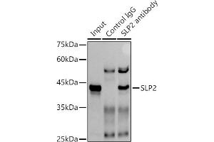 Immunoprecipitation analysis of 300 μg extracts of A-549 cells using 3 μg SLP2 antibody (ABIN7270675). (SYTL2 antibody)