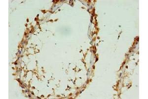 Immunohistochemistry of paraffin-embedded human testis tissue using ABIN7149304 at dilution of 1:100 (CYTL1 antibody  (AA 24-136))