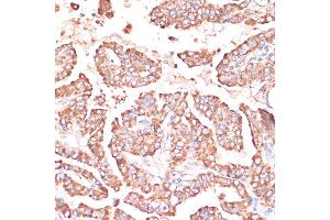 Immunohistochemistry (IHC) image for anti-FERM Domain Containing 6 (FRMD6) (AA 405-614) antibody (ABIN6140773)