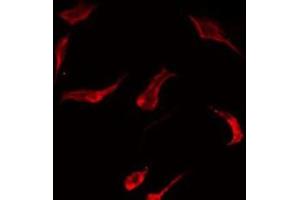 ABIN6275473 staining HT29 by IF/ICC. (RAB7L1 antibody  (Internal Region))