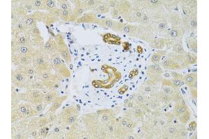 Immunohistochemistry of paraffin-embedded human liver injury using RAB27A Antibody (ABIN5970998) at dilution of 1/100 (40x lens). (RAB27A antibody)