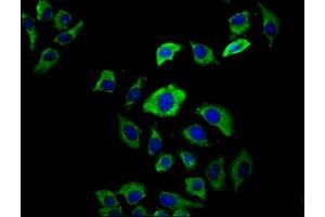 Immunofluorescence staining of A549 cells with ABIN7158397 at 1:66, counter-stained with DAPI.