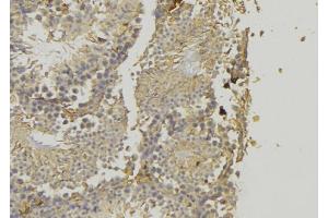 Immunohistochemistry (IHC) image for anti-Perilipin 1 (PLIN1) (C-Term) antibody (ABIN6264141)