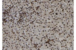 ABIN6273187 at 1/100 staining Human liver tissue by IHC-P. (ZC3HAV1 antibody  (Internal Region))