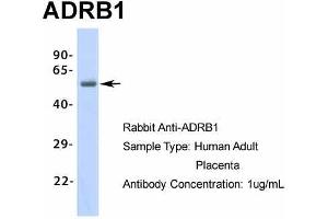Host: Rabbit Target Name: ADRB1 Sample Type: Human Adult Placenta Antibody Dilution: 1.