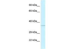 WB Suggested Anti-ALKBH1 Antibody Titration: 1. (ALKBH1 antibody  (N-Term))