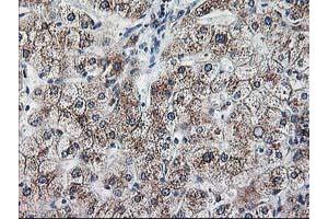 Immunohistochemical staining of paraffin-embedded Human liver tissue using anti-RPN1 mouse monoclonal antibody.