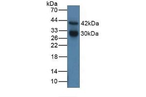 Detection of CTSG in Human MCF7 Cells using Polyclonal Antibody to Cathepsin G (CTSG) (Cathepsin G antibody  (AA 21-255))