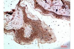 Immunohistochemical analysis of paraffin-embedded human-skin, antibody was diluted at 1:200 (TPSD1 antibody  (AA 51-100))