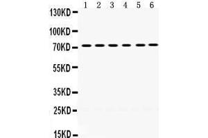 Western Blotting (WB) image for anti-LIM Domain Kinase 2 (LIMK2) (AA 596-635), (C-Term) antibody (ABIN3043412) (LIMK2 antibody  (C-Term))