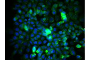 Immunofluorescence (Cultured Cells) (IF (cc)) image for anti-Eukaryotic Translation Initiation Factor 4E (EIF4E) (AA 121-217) antibody (ABIN1386772)