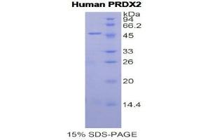 SDS-PAGE (SDS) image for Peroxiredoxin 2 (PRDX2) (AA 6-164) protein (His tag,GST tag) (ABIN1877330) (Peroxiredoxin 2 Protein (PRDX2) (AA 6-164) (His tag,GST tag))