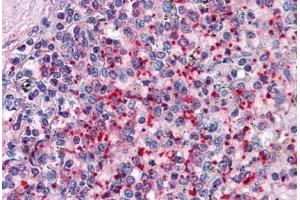 Human Spleen: Formalin-Fixed, Paraffin-Embedded (FFPE) (TLN1 antibody  (AA 1052-1150))