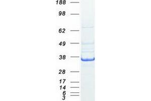 Lactate Dehydrogenase C (LDHC) (Transcript Variant 1) protein (Myc-DYKDDDDK Tag)