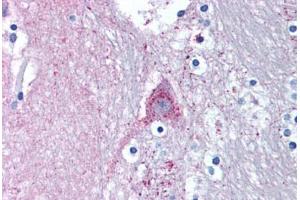 Human Brain, Caduate (formalin-fixed, paraffin-embedded) stained with MARK1 antibody ABIN239802 at 5 ug/ml followed by biotinylated goat anti-rabbit IgG secondary antibody ABIN481713, alkaline phosphatase-streptavidin and chromogen. (MARK1 antibody  (N-Term))