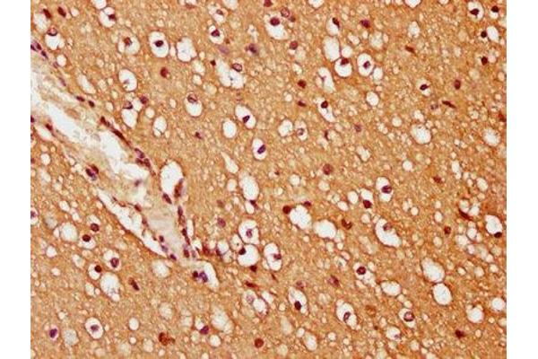 TRIM45 antibody  (AA 428-573)